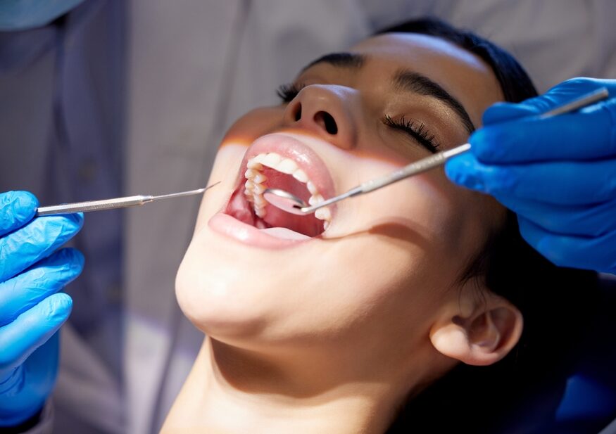 teeth cleaning