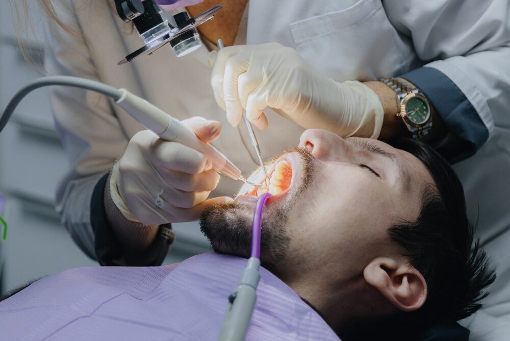 dental root canal services