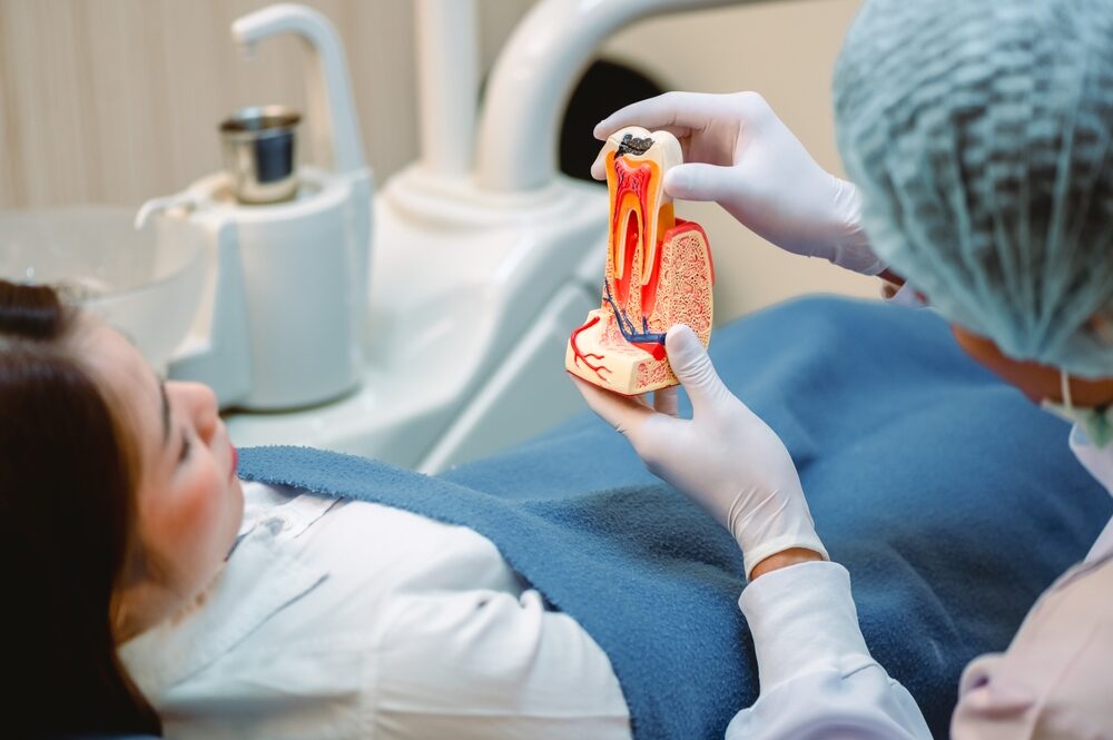 root canal procedure